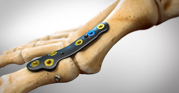 medical devices