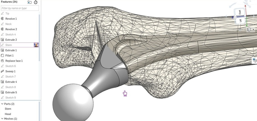 medical device design